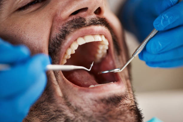 Best Broken Tooth Emergency  in Paisley, FL